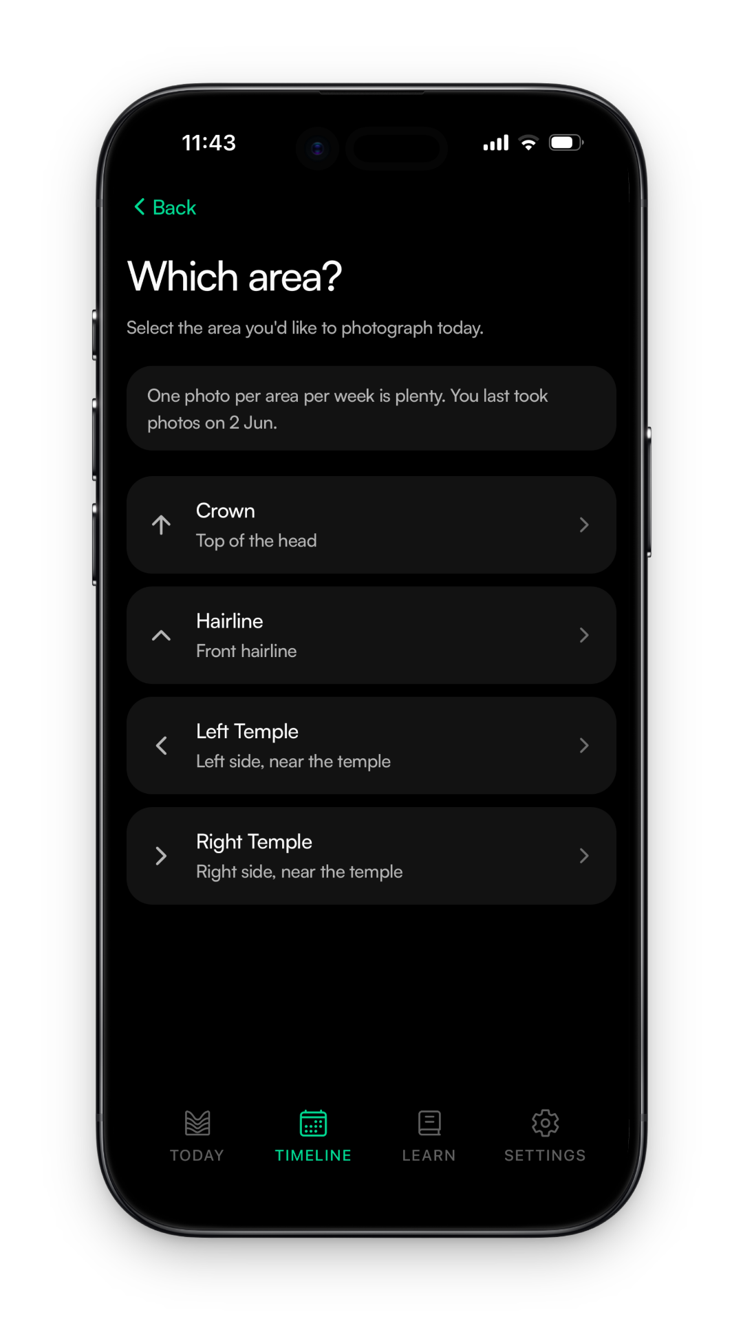Manestay screen for choosing which scalp area to photograph for progress tracking
